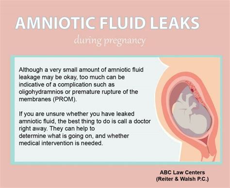 leaking amniotic fluid symptoms|Signs Of Leaking Amniotic Fluid Vs. Discharge: The Difference